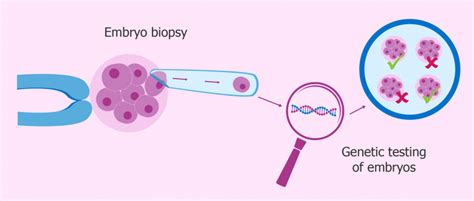 What Is Pgd Or Preimplantation Genetic Diagnosis