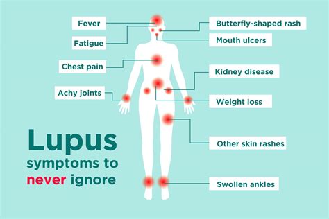 lupus signs  symptoms        lupus