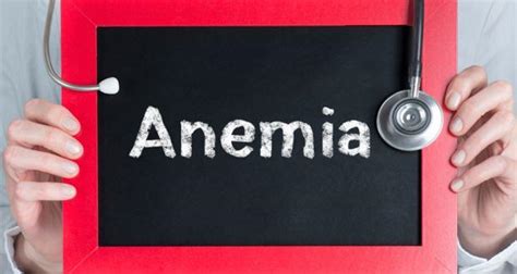 top 10 symptoms of anemia you should know about read