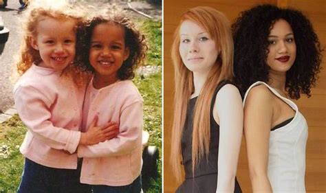 Meet The Twins With Different Coloured Hair Eyes And Skin Uk News