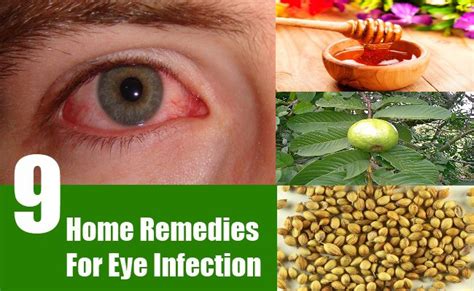 home remedies  eye infection search home remedy