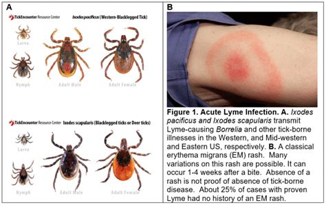 Lyme Disease Research – Naviaux Lab