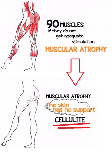 what is the truth about cellulite a review of this product reveals all