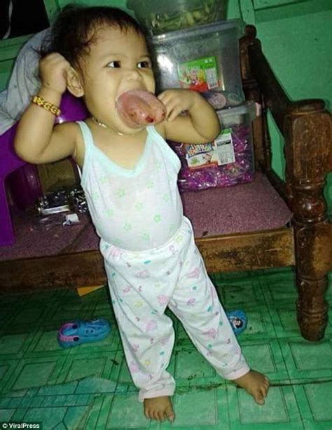filipino girl is being suffocated by tumour ridden tongue daily mail online