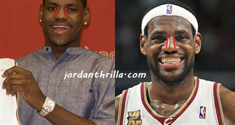 anonymous doctor accuses lebron james    nose job plastic surgery
