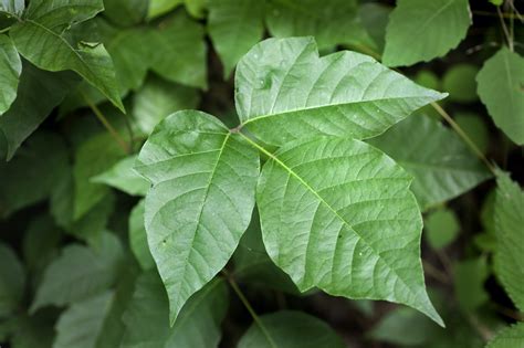 natural remedies  poison ivy lindsey elmore