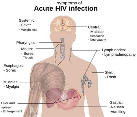 Hiv Aids Causes Symptoms Treatment Diagnosis And