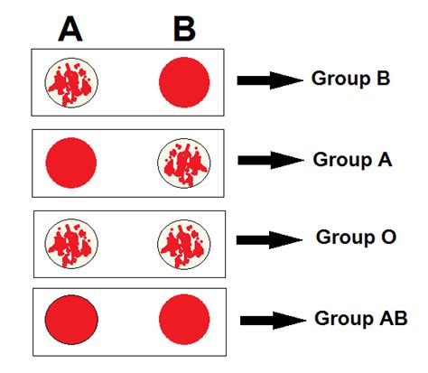 reverse blood grouping principle procedure result