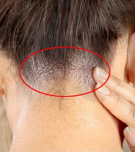 hair fungus causes and how to stop them glowpink hair control