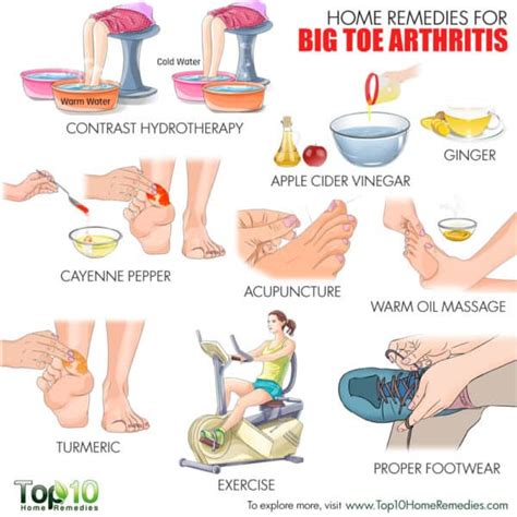 home remedies  big toe arthritis top  home remedies