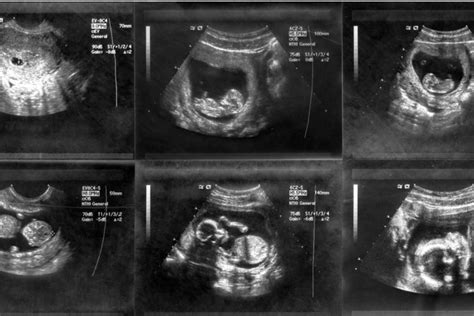 week by week pregnancy scan photos netmums