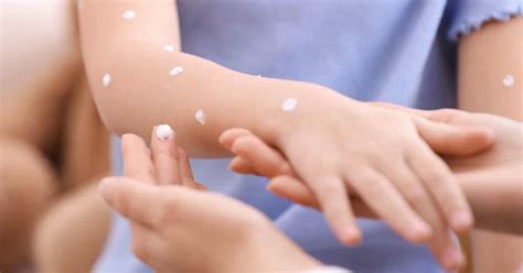 tips  kids sensitive skin living  spending