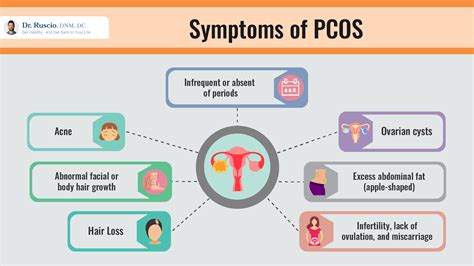 research backed supplements  pcos
