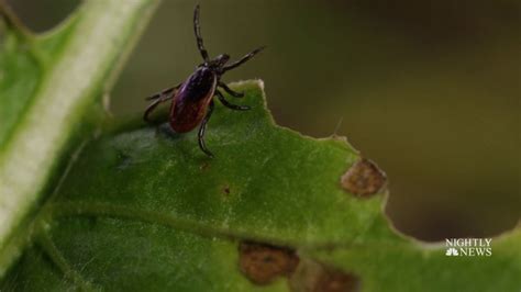 Alpha Gal Syndrome From Tick Bites Can Cause Meat Allergy
