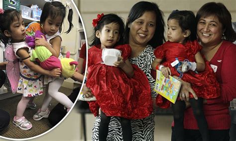 Conjoined Twins Angelica And Angelina Sabuco Prepare To
