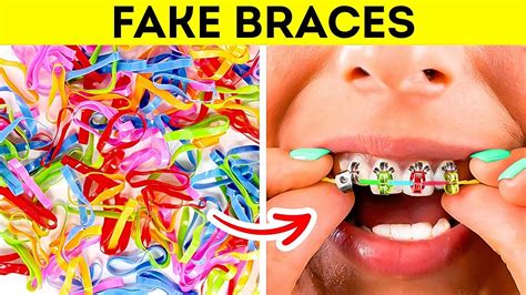 Diy Fake Braces Craziest Girly Hacks Ever By 5 Minute Crafts Like
