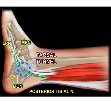 lateral plantar nerve anatomy orthopaedicprinciplescom