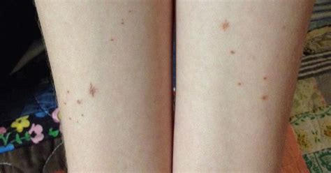 pisces constellation tattoo done up to look like freckles