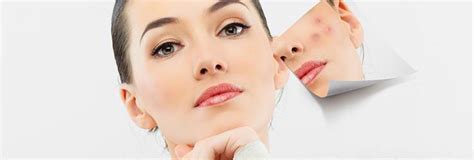 zits  management  acne  adults zitsenoughmanagementofacneinadults tips