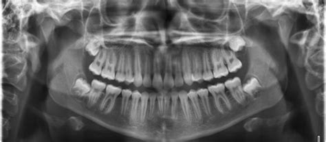 extraoral digital imaging dental arts  boynton beach florida