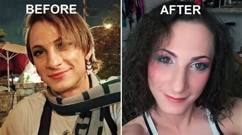 Physical And Mental Effects Of Hrt Transgender Mtf 3 5 Months On