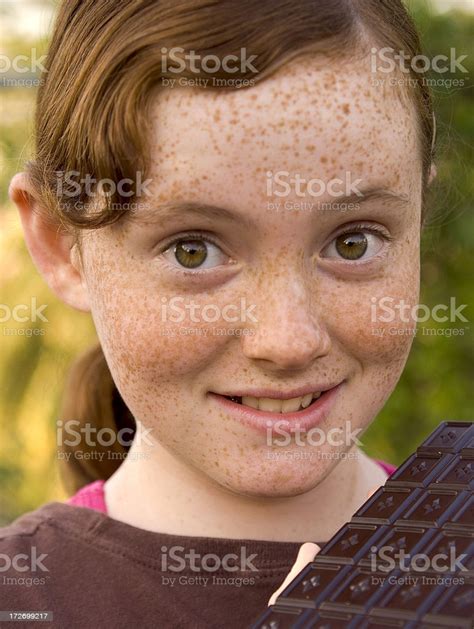 Redhead Freckle Face Girl With Big Eyes Chocolate Bar