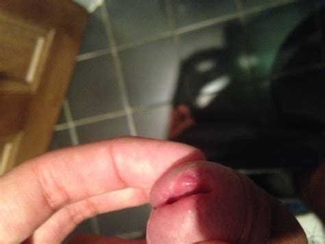 redness around penis pee hole porn tube