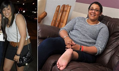 Jordon Moody Who Lost Part Of Her Leg To Cancer Has New