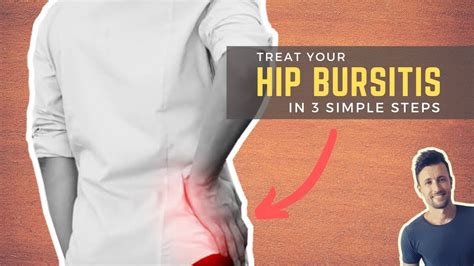 fix hip bursitis  simple steps bursitis hip bursitis hips