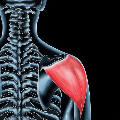 deltoid muscle injuries effective healing treatments
