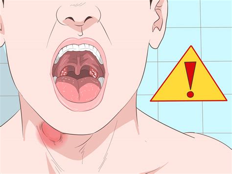 rid   sore throat quickly  pictures wikihow