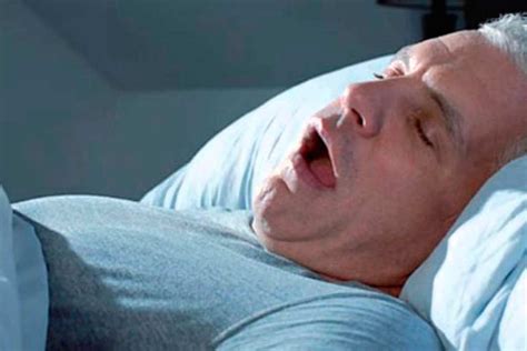 la apnea obstructiva del sueño relacionada con cambios en
