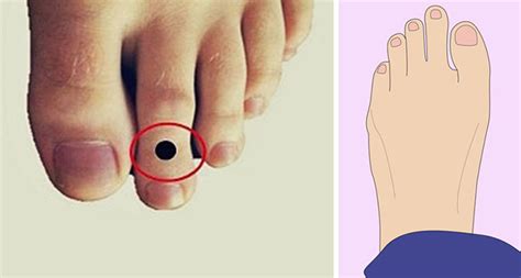 This Is What It Means If Your Second Toe Is Longer Than