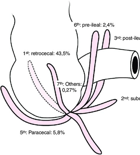positions   vermiform appendix  scientific diagram