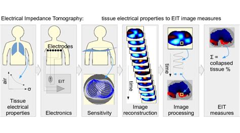 electrical impedance tomography tissue properties  image measures ieee transactions
