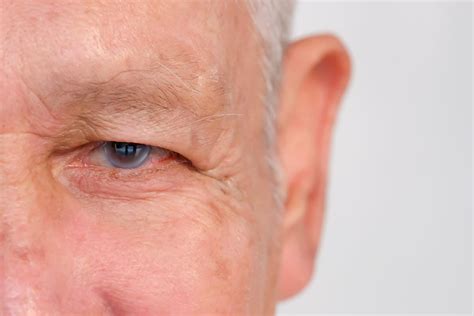 Glaucoma Symptoms Causes Diagnosis And Treatment