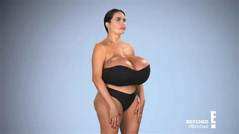 Model Gets Insane Zz Cup Breasts By Injecting Litres Of Saline Into
