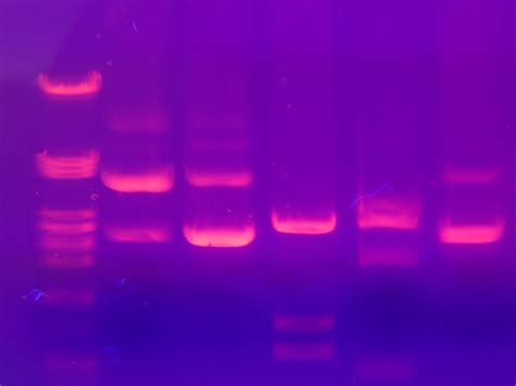 Agarose gel band analysis