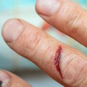 laceration wound care medfriendlycom