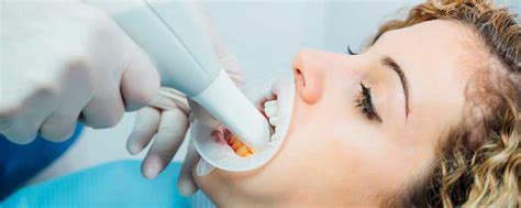 ¿por Qué Es Importante El Escáner Intraoral Sanz Clínica Dental