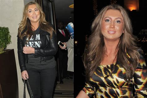 Lauren Goodger Denies Plastic Surgery Rumours And Blames Puffy Face On