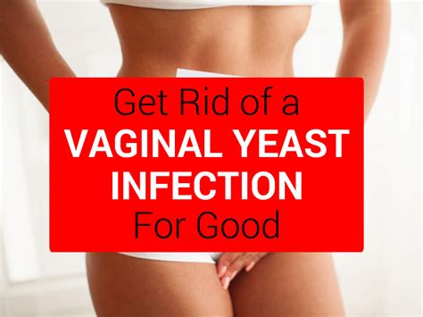vaginal yeast infection 5 easy home remedies to cure this condition