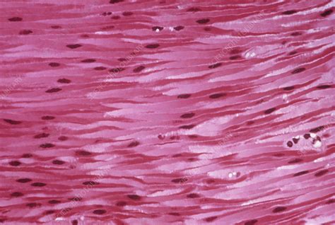 lm   section  human smooth muscle tissue stock image p