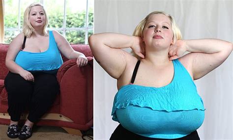 Nhs Refuses To Pay For Surgery To Reduce Woman S Massive 42n Breasts
