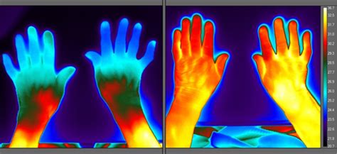 hot  cold    thermal imaging  care homes