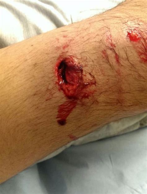 pizza delivery man left with horrific injuries after being mauled on
