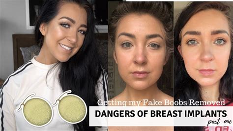 how my fake boobs made me sick breast explant journey pt 1 youtube