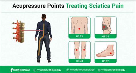 acupressure points  treating sciatica pain modern reflexology