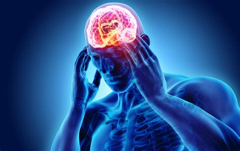 glavobolja  predelu temena sta sve moze da znaci  koji su joj uzroci eklinika