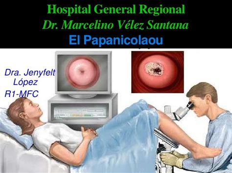 Prueba De Papanicolau Y Virus Del Papiloma Humano Vph